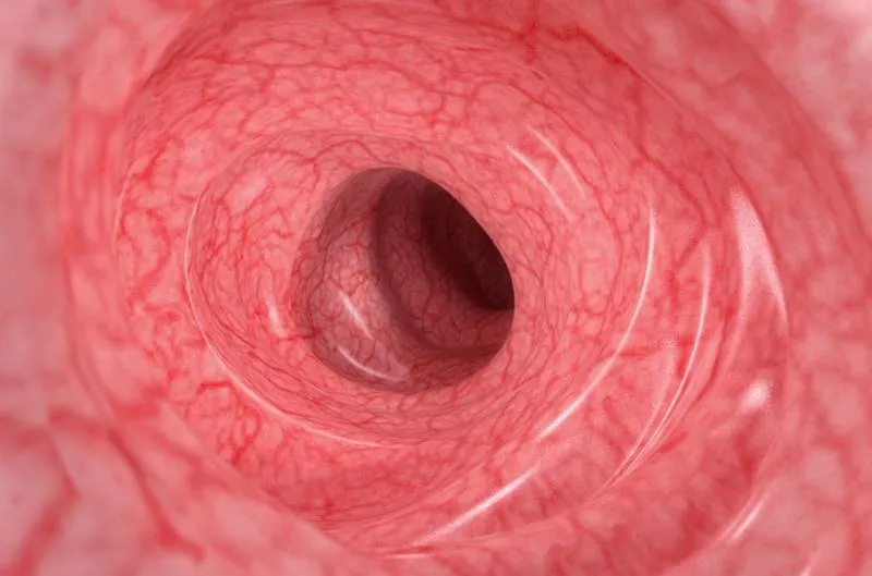 Inside of a digestive tract - Crohn’s remission