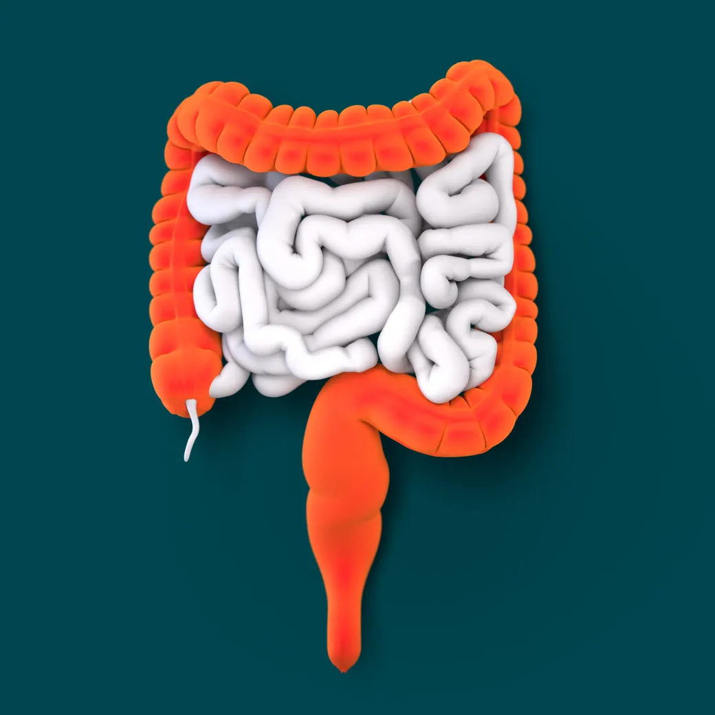 Inside of a digestive tract – ulcerative colitis
